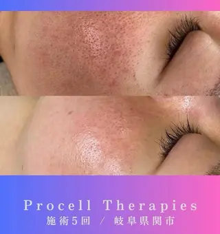 氣楽所属・松下 さゆりのエステ・リラクイメージ