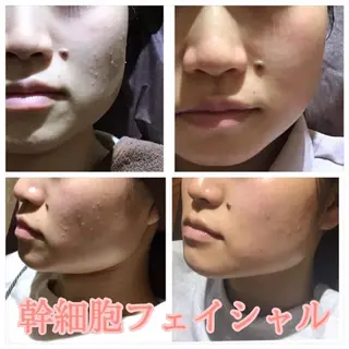 エヴァーグレース 河原町店のエステ・リラクイメージ