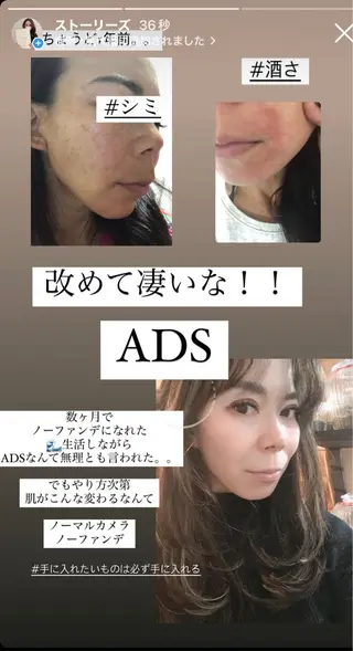 private salon Dea_maris シュガーリング&パーソナルボディケア所属・シミ改善・韓国肌管理 ボディメイク痩身のその他イメージ