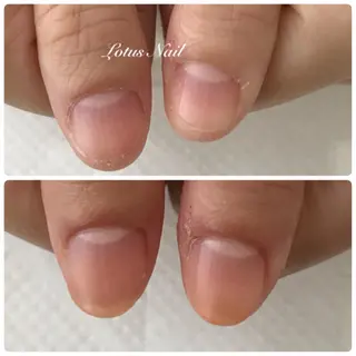 ネイル Lotus Nailのネイルデザイン