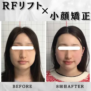 小顔矯正専門店 ❤️池田 桃花のエステ・リラクイメージ