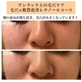 Bellesthe (ベルエステ)のエステ・リラクイメージ