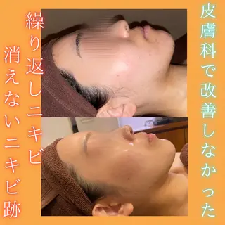 痩身&美肌サロン ビュースタ 伊藤🌷のその他イメージ