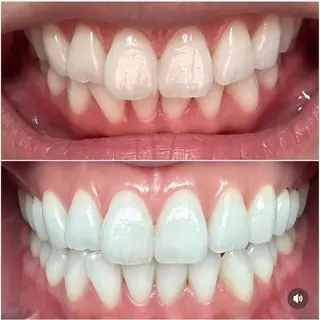 ホワイトニングジム 池袋のその他イメージ