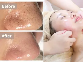 小顔コルギ・美肌 グラシーズのエステ・リラクイメージ