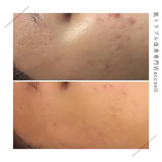 ミディアム カラー パーマ ヘアアレンジ メンズ キッズ ネイル マツエク・マツパ アイブロウ 触れたくなる モテ肌へ...❤︎のエステ・リラクイメージ