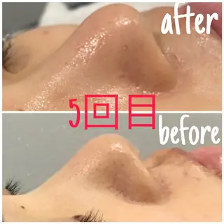 毛穴洗浄・痩身・脱毛 /アルカンジュのエステ・リラクイメージ