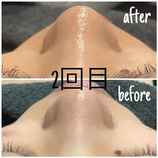 毛穴洗浄・痩身・脱毛 /アルカンジュのエステ・リラクイメージ