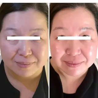 Astorie 相模大野エステのその他イメージ