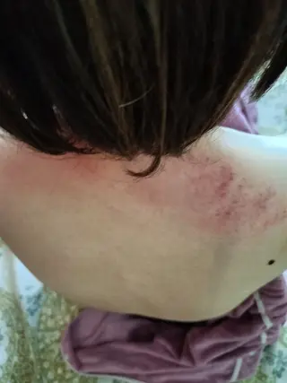 ☺ハーブピール💕 ソフィアカロン💖のエステ・リラクイメージ