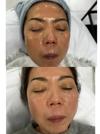 MIKA ♡のネイルデザイン