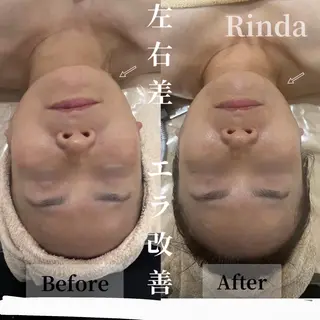 ブライダル痩身×脱毛 尼崎駅前サロンのエステ・リラクイメージ