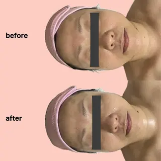 gleam ü 枚方公園のエステ・リラクイメージ