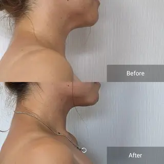 nail RiRi アトレナチュラのエステ・リラクイメージ