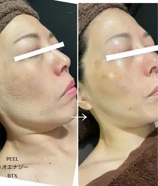 Total Beauty salon Bloom所属・トータルビューティー サロン　Bloomのエステ・リラクイメージ