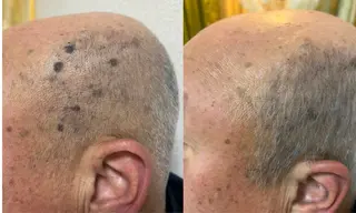 ソアラ所属・八王子 ソアラのマツエク・マツパデザイン