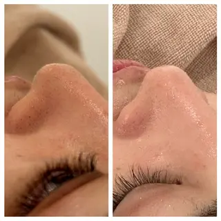 ANERA Second所属・尾上 沙織のエステ・リラクイメージ