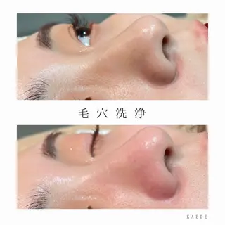 🎀kaede🎀 骨格似合わせ眉毛の眉毛・アイブロウイメージ