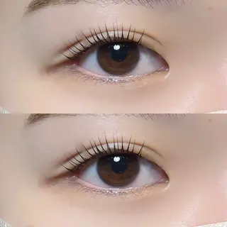 ใใใจใฏใปใใใ ๐๐๐๐๐ ๆ่ฑใฎใใใจใฏใปใใใใใถใคใณ