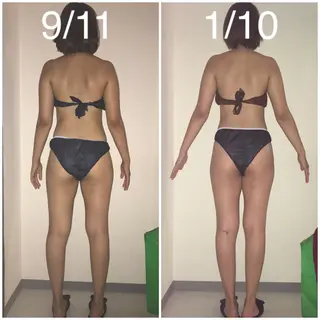 高速脱毛エステ リアンのエステ・リラクイメージ