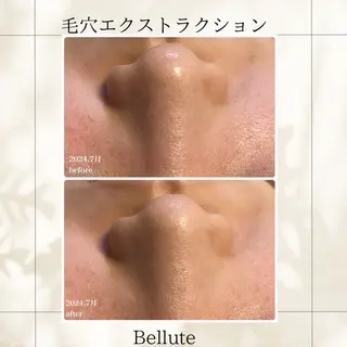 ピーリング専門店 Belluteのエステ・リラクイメージ