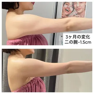 部分痩せ♥️小顔専門 MIKUのエステ・リラクイメージ