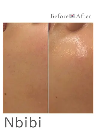 韓国🇰🇷価格 サロン_Nbibiのエステ・リラクイメージ