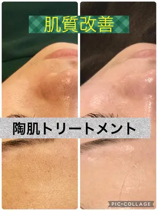 Dione八王子店所属・Dione 八王子店のエステ・リラクイメージ