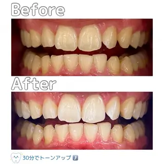 Whitening Beauty 市川妙典店所属・天根 春香のエステ・リラクイメージ