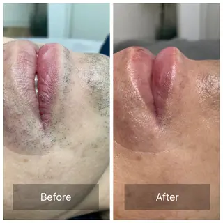 Lumiere despoir所属・Lumiere despoirのエステ・リラクイメージ