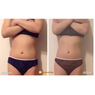 小尻・太もも痩せる エステルナボーテのエステ・リラクイメージ