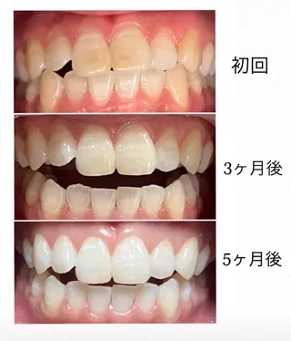 ベルーテ エッセンスのエステ・リラクイメージ