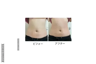 隠れ家エステ chapoのエステ・リラクイメージ