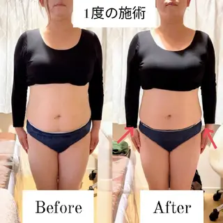 深層リンパの癒し 美姿勢×痩身✨のエステ・リラクイメージ