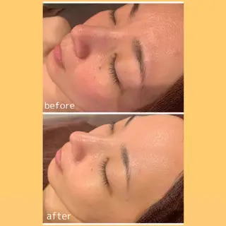 🎀葛野 日向子🎀のエステ・リラクイメージ