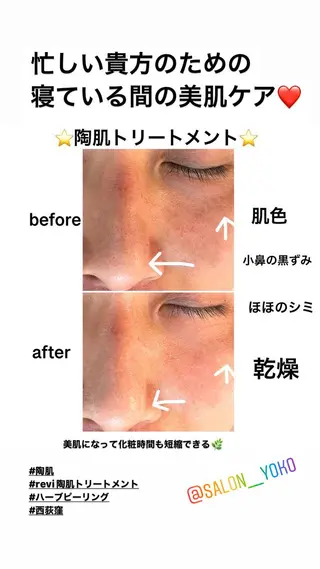 アロマ,陶肌 SalonYokoのエステ・リラクイメージ