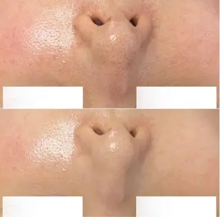 毛穴レス美肌へ🌿 看護師Abe🌼のエステ・リラクイメージ