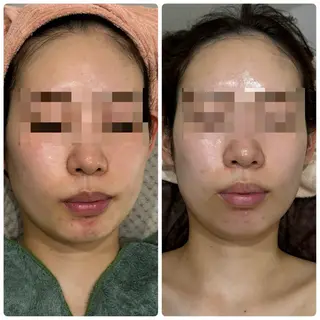 脱毛&フェイシャル 専門店muro.のエステ・リラクイメージ