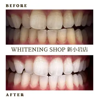 メンズ ホワイトニング ショップ新小岩店のその他イメージ