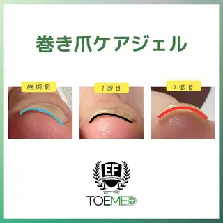 メンズ ネイル 爪ケア/深爪 自爪育成 🐰えむのネイルデザイン