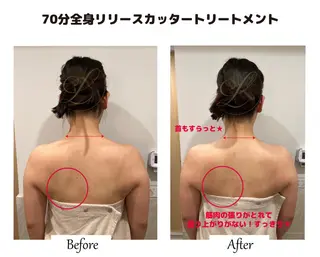 痩身×フェイシャル ブライダル|Linoのエステ・リラクイメージ