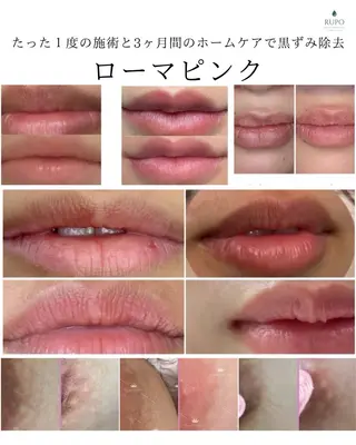 医療提携認定サロン　RUPO THE MAINTENANCE新潟店【ローマピンク/ララピール】所属・オーナー Nanjoのエステ・リラクイメージ