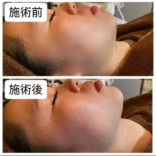 肌質改善専門 ハーブ /毛穴洗浄 リエイトのエステ・リラクイメージ