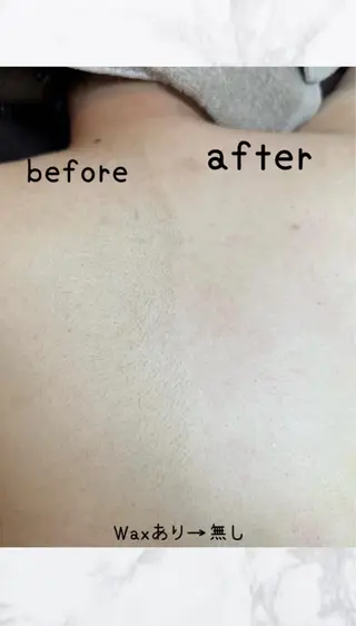 AngelWax【エンジェルワックス】川崎店所属・ブラジリアンワックス ・エステサロンのエステ・リラクイメージ