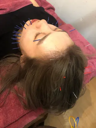 美容鍼灸女性専用 りんご鍼灸治療院のその他イメージ