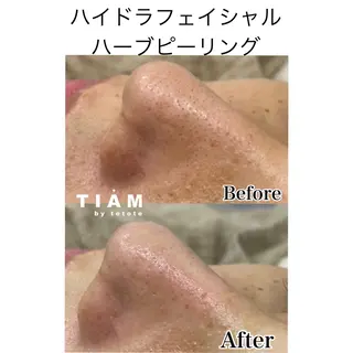 美肌サロンTIAM by tetoteのエステ・リラクイメージ