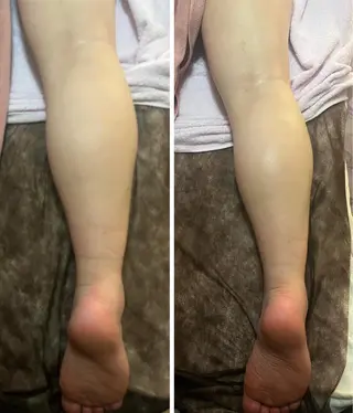 アロマ･美容鍼･カッ ピング「麗」鍼灸院のエステ・リラクイメージ