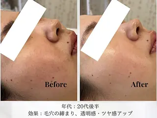 Astorie 相模大野エステのその他イメージ