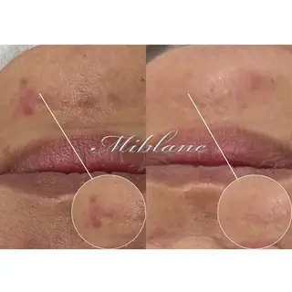 肌質管理 MIBLANC上野店のエステ・リラクイメージ