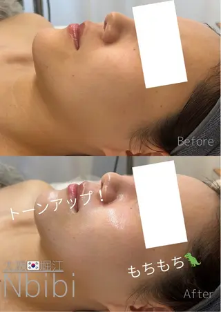 韓国🇰🇷価格 サロン_Nbibiのエステ・リラクイメージ